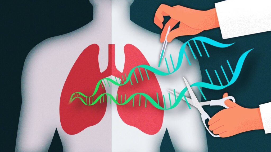Cystic Fibrosis